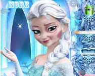 Elsa rejuvenation online játék